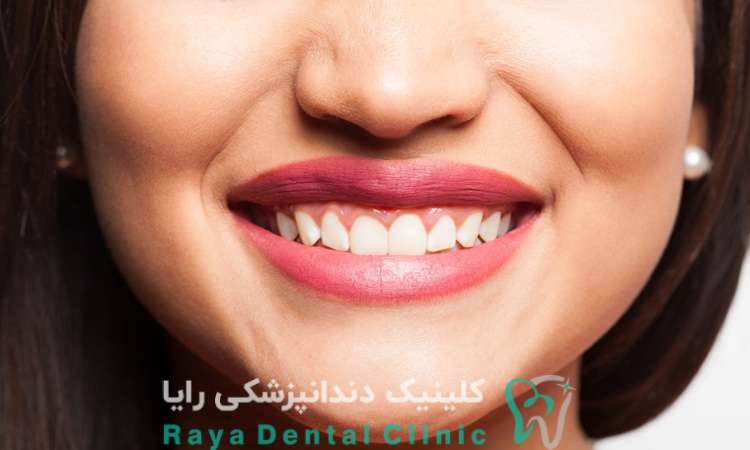 دندانپزشک متخصص زیبایی