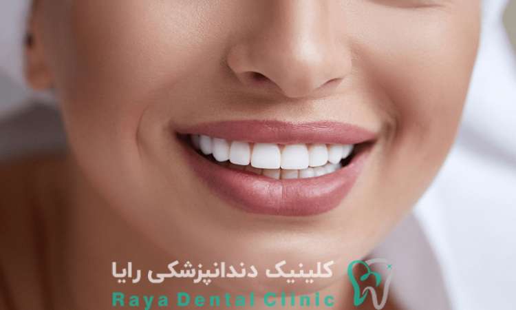 راز طراحی لبخند