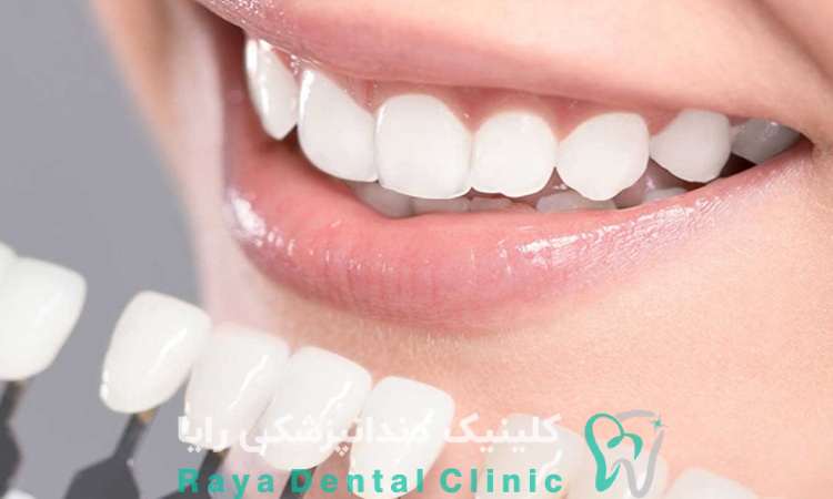  لمینیت کم تهاجم