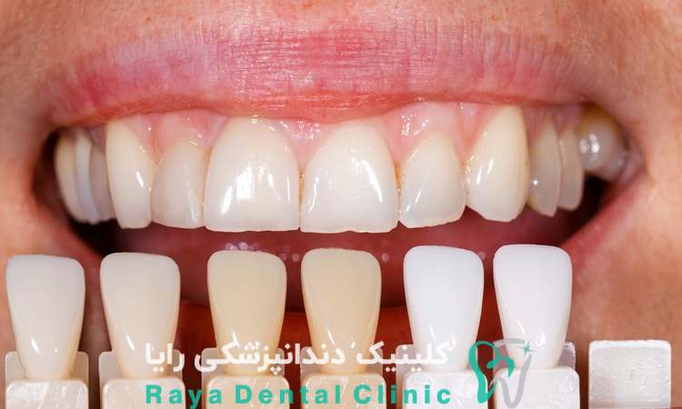مراقبت از لثه