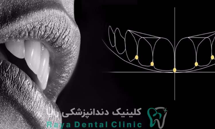 طراحی لبخند دیجیتال