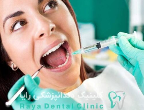 روش‌ های نوین بی‌ حسی در کاشت دندان بدون درد