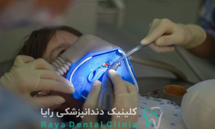 سدیشن دندانپزشکی