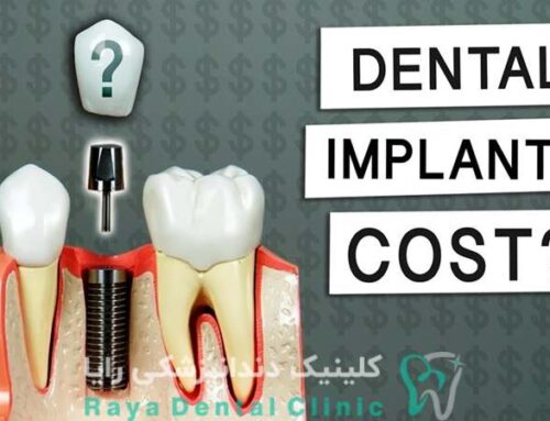 آیا افزایش نرخ دلار روی قیمت کاشت دندان تاثیر دارد؟