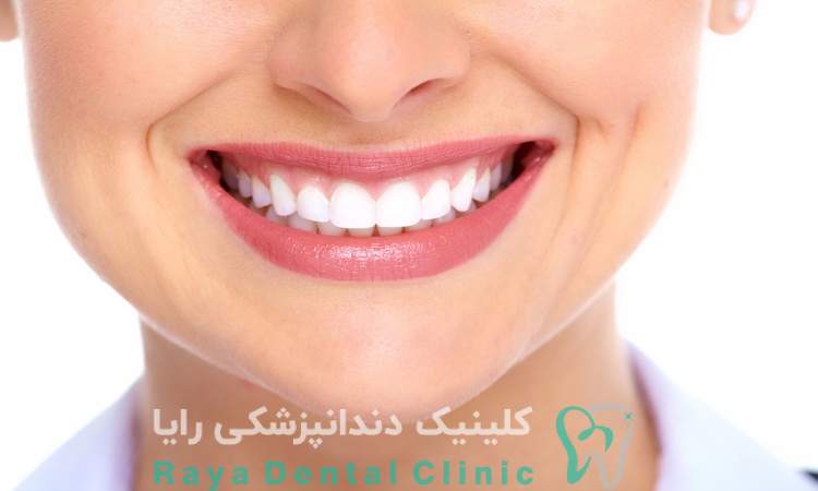 ایمپلنت دیجیتال با لیزر