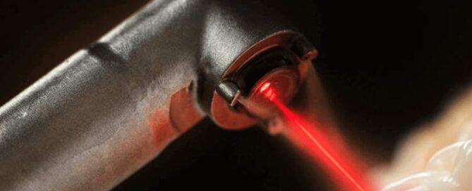 ایمپلنت با لیزر