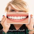 هزینه طراحی لبخند