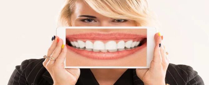 هزینه طراحی لبخند