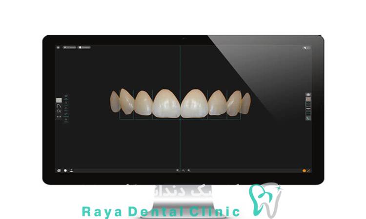 لبخند دیجیتال