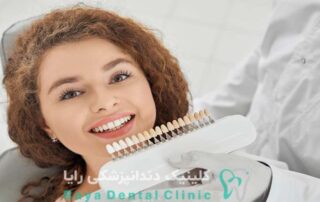 لمینیت فوری دندان