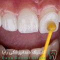 نقش ضخامت لمینیت