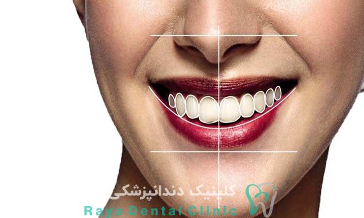 طراحی لبخند دیجیتال