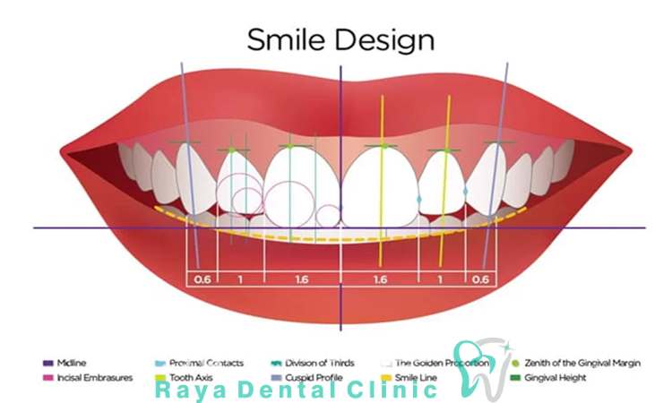 مزایا طراحی لبخند