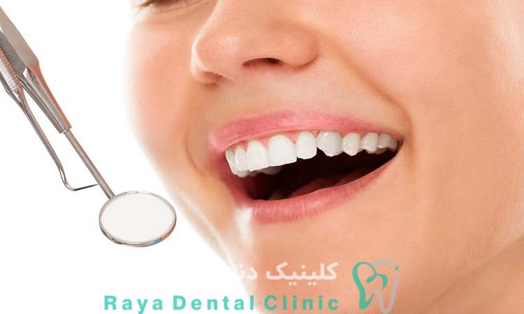 رعایت بهداشت پس از لمینیت