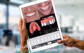 دقت اسکن دیجیتال