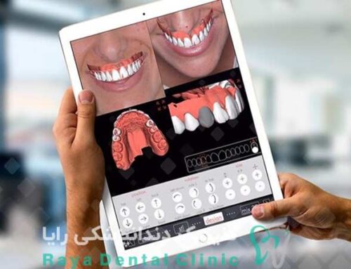 چرا دقت اسکن دیجیتال در طراحی لبخند اهمیت دارد؟