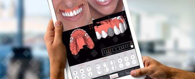 دقت اسکن دیجیتال