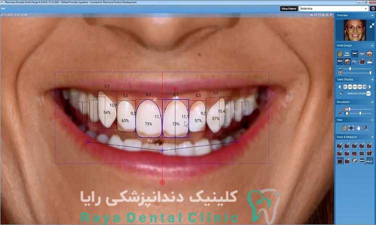نقش اسکن دیجیتال