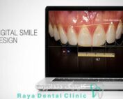 طراحی لبخند دیجیتال