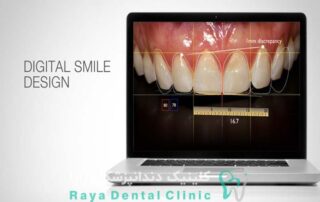 طراحی لبخند دیجیتال