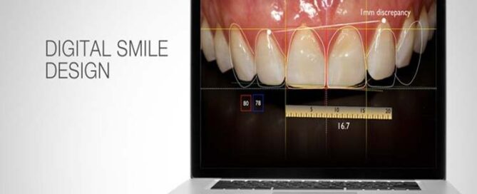 طراحی لبخند دیجیتال