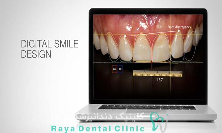 طراحی لبخند دیجیتال