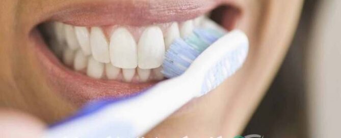 ماندگاری لمینیت دندان