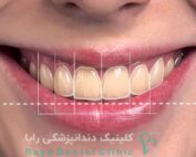 طراحی لبخند دیجیتال