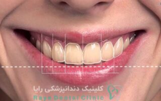 طراحی لبخند دیجیتال