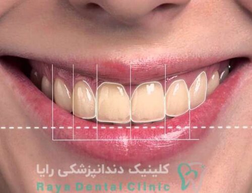 راهکارهای ترکیبی برای طراحی لبخند دیجیتال و سفید کردن دندان‌ ها