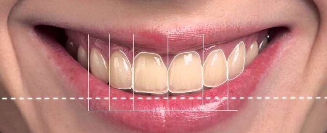 طراحی لبخند دیجیتال