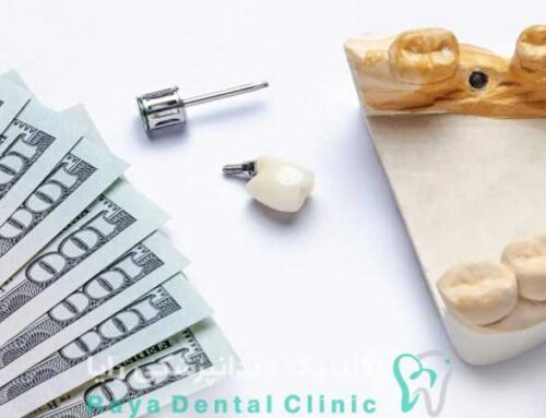 هزینه ایمپلنت دندان در سال ۱۴۰۴