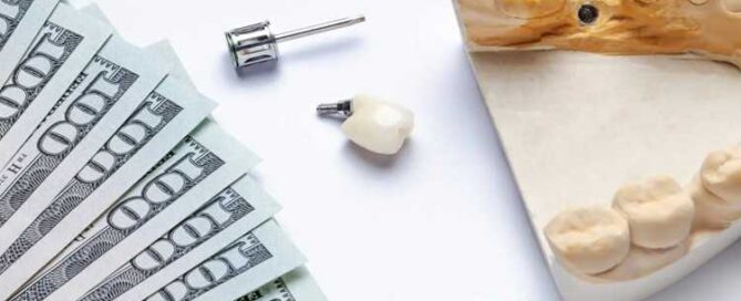 هزینه ایمپلنت دندان