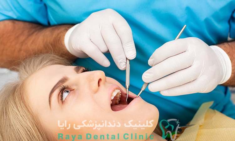 کشیدن دندان عقل