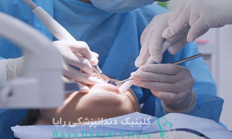 متخصص جراحی دندان عقل