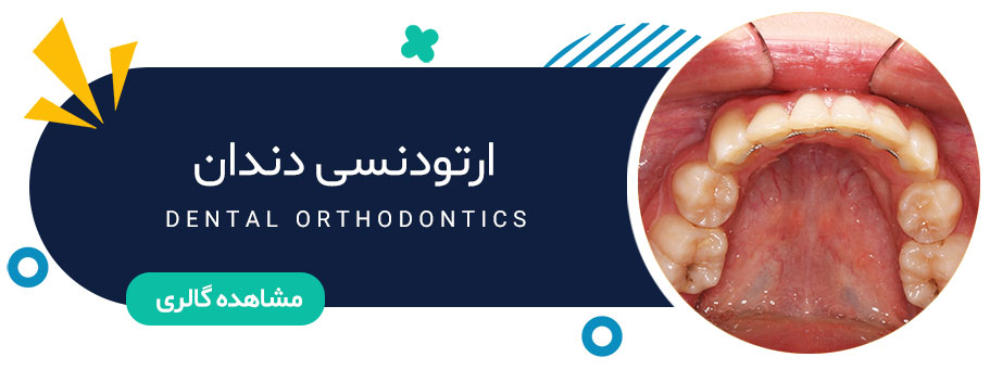 نمونه کار ارتودنسی دندان