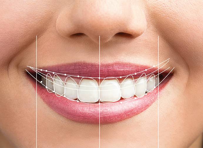 Smile design correction اصلاح طرح لبخند