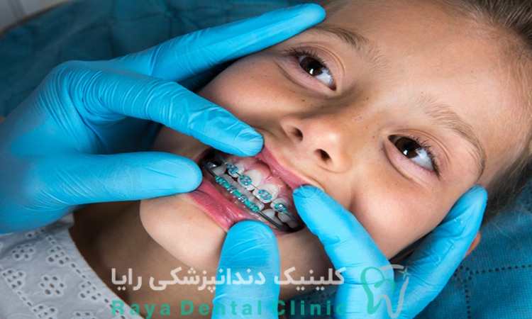 هزینه ارتودنسی