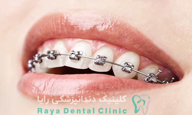 ارتودنسی چیست