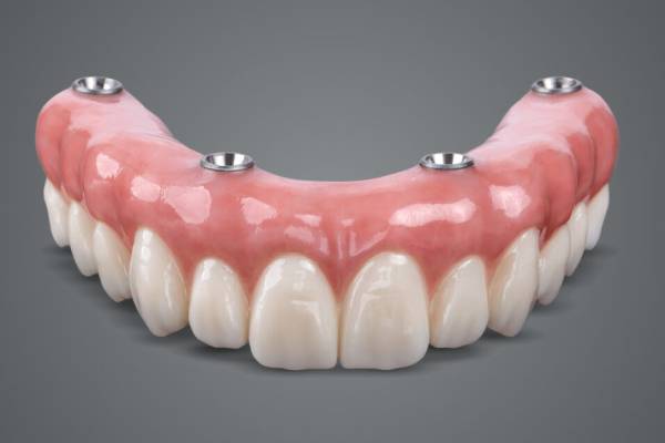 fixed-denture روکش های دندانی