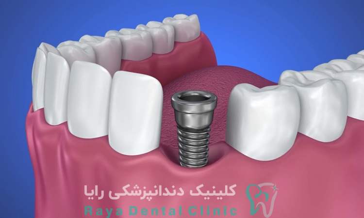 معیارهای انتخاب یک دندانپزشک