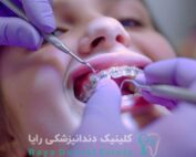 اصلاح عادات مکیدن انگشت