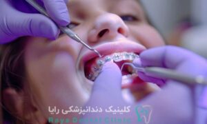 اصلاح عادات مکیدن انگشت