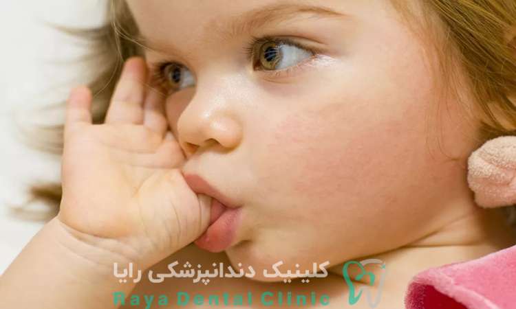 پلاک های پیشگیری ارتودنسی