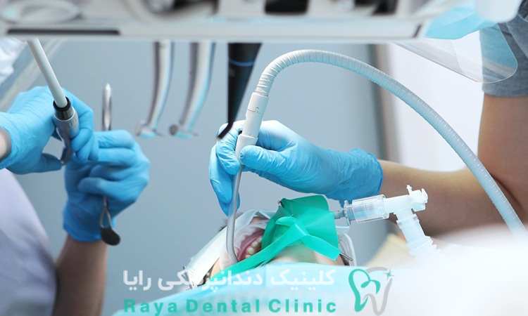 مزایا و محدودیت های سدیشن سبک