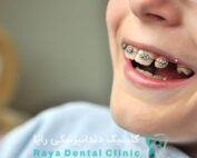 درمان ارتودنسی دندان