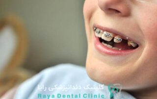 درمان ارتودنسی دندان