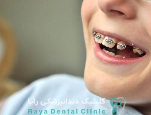 آیا درمان ارتودنسی برای کودکان درد دارد؟