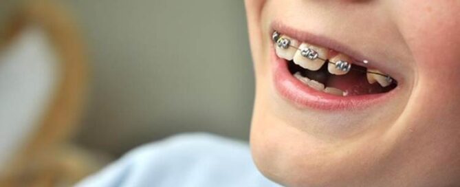 درمان ارتودنسی دندان