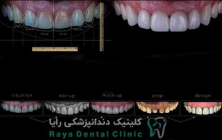 طراحی حرفه ای لبخند